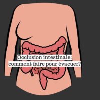 Occlusion intestinale: comment faire pour évacuer?